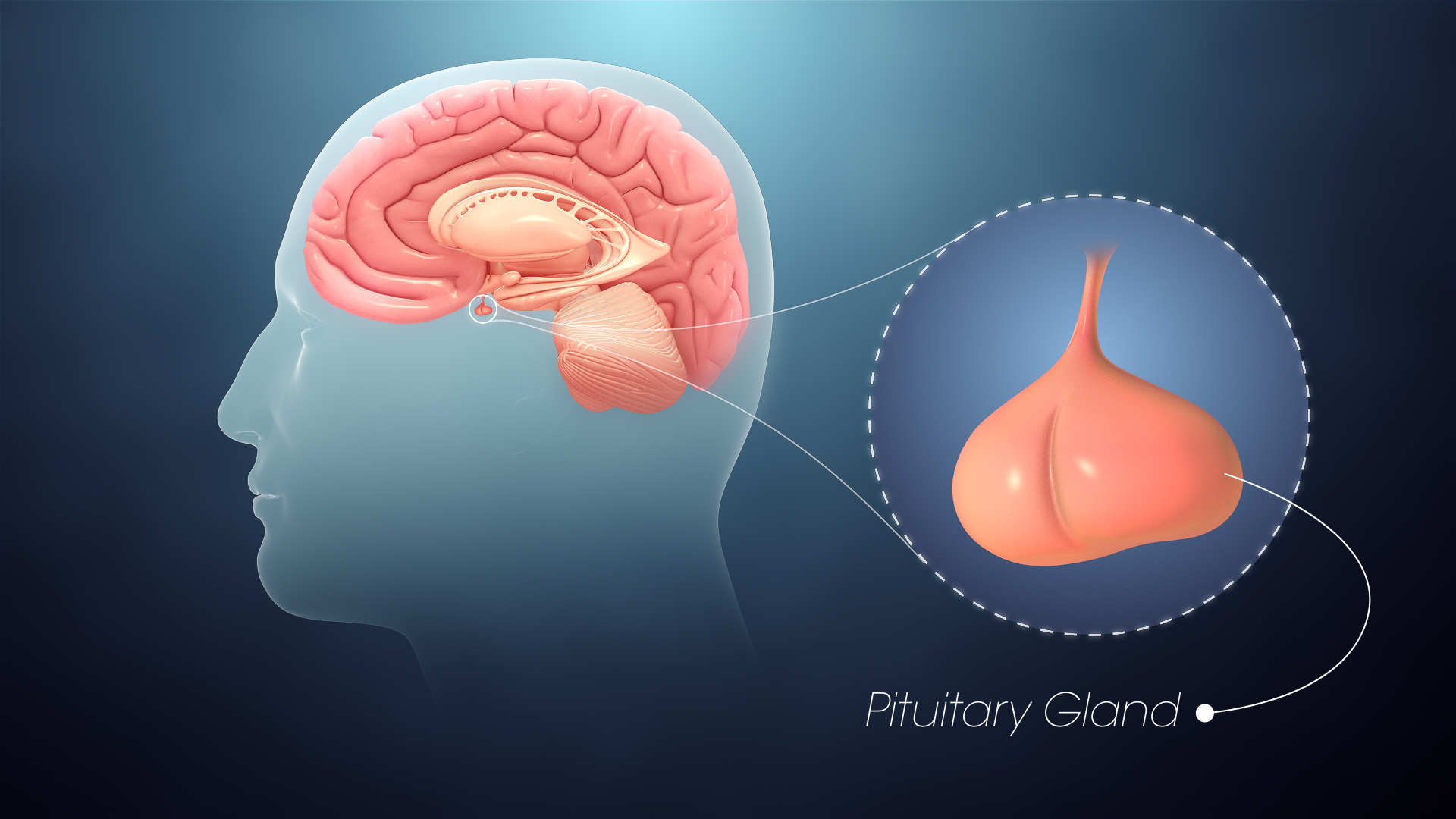 Pituitary Disorders